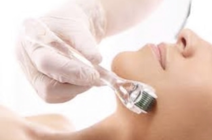 Micro Needling